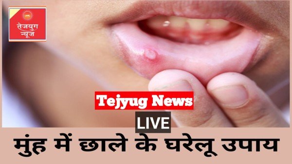 मुंह में होने वाले छालों से पाएं छुटकारा, नहीं करना पड़ेगा परेशानियों का सामना