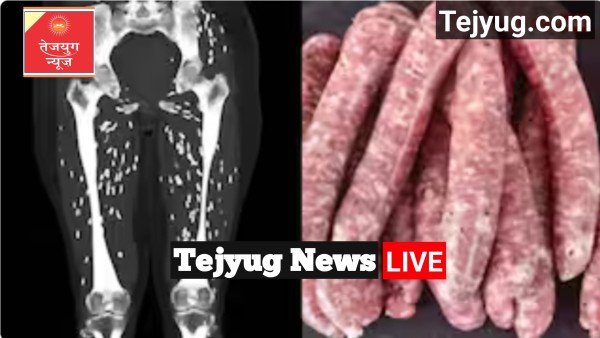 अधपके सुअर का मांस खाने वाले शख्स का CT स्कैन देख डॉक्टर भी हैरान, पैरों में दिखी ये चीज