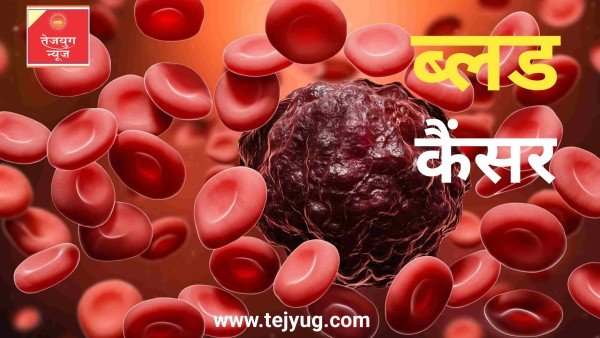 अगर किसी व्यक्ति को ब्लड कैंसर है तो शरीर पर किस तरह के लक्षण दिखाई देंगे?