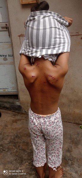 पालतू कुत्ते ने मासूम पर किया हमला