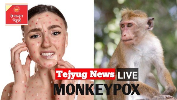 कोरोना की तरह महामारी बनता जा रहा मंकीपॉक्स, अफ्रीका के बाहर भी मिल रहे मरीज; 100 से ज्यादा लोगों की हुई मौत