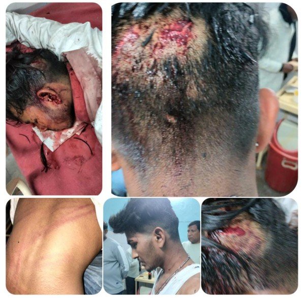 घरातियों ने बरातियों पर हमलाकर घायल किया हायर सैंटर रैफर।