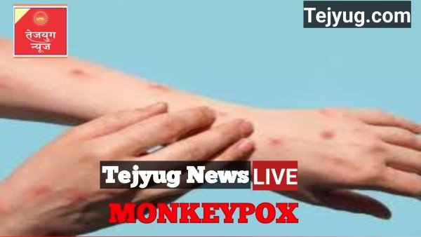 मंकीपॉक्स या कोरोना नहीं... इस बीमारी से सबसे ज्यादा डरते हैं भारत के लोग, सर्वे में हुआ बड़ा खुलासा