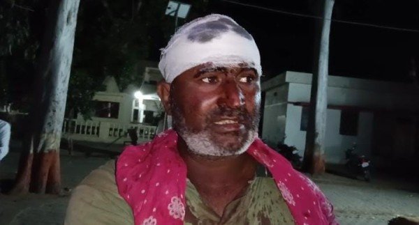 बीस रूपये के चक्कर में फूटंे सिर किसान ने दी तहरीर